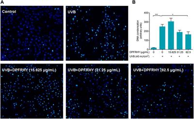 Effects of Collagen Hydrolysate From Large Hybrid Sturgeon on Mitigating Ultraviolet B-Induced Photodamage